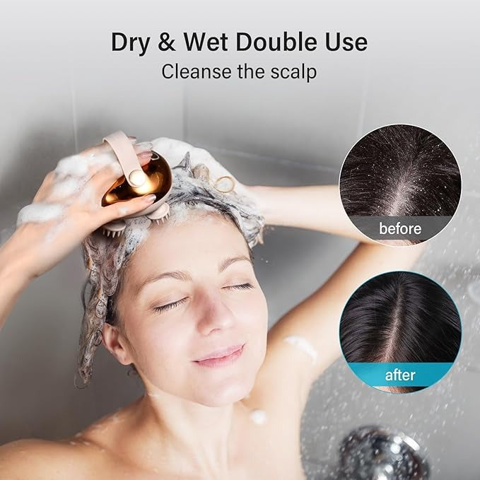 Electric Scalp Massager Head Massager Scalp Stress Relax, 5 in 1 Kneading 128 Massage Nodes, Waterproof Hair Massage with 8 Removable Claws Cat Scratcher, Gift for Dad Mom
