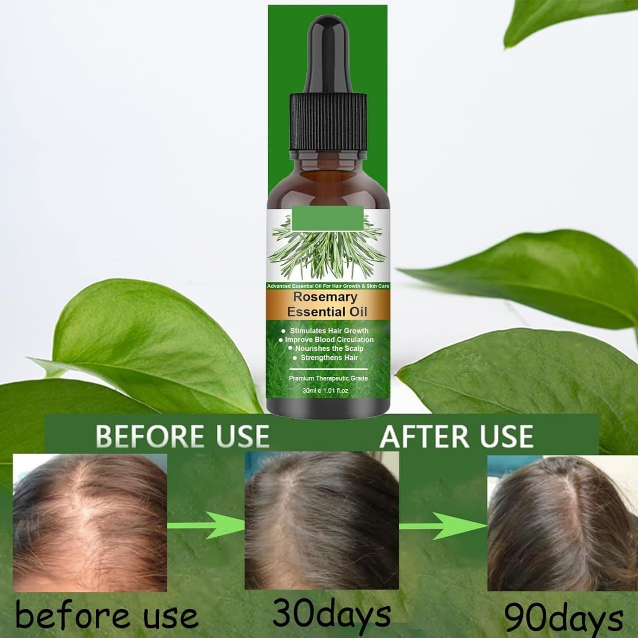 EELHOE Rosemary Essential Hair Oil - Nourishing Vegan Formula for Lustrous Locks and Scalp Wellness - 30ML